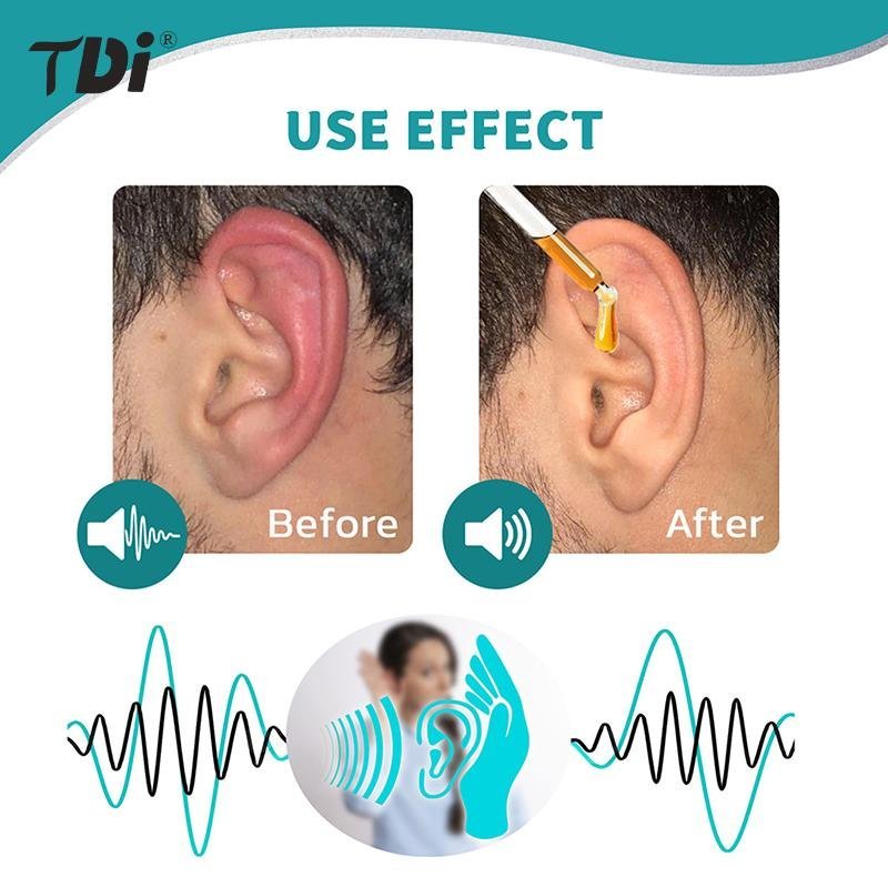 1pcs 10ml Ear Ringing Relieving Drops Relieve Deafness Tinnitus Itching Earache Health Care Treatment Relief Drops - Image 4